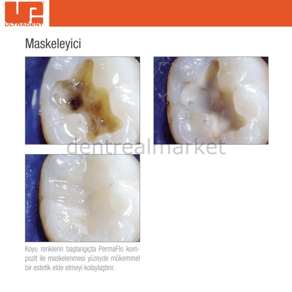 PermaFlo Dentin Opaquer Kompozit Refil