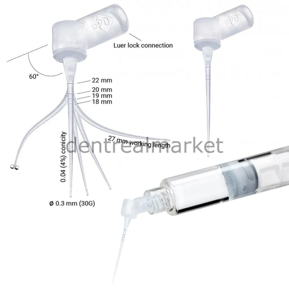 Irriflex İrrigasyon İğnesi 40'lik