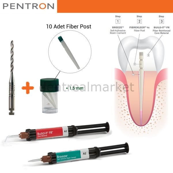 Post-Core Sistem Kit-FibreKleer Fiber Post 1.50mm- Breeze Self Adeziv-Build-it Kor Materyeli
