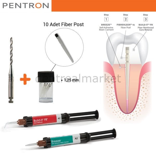 Post-Core Sistem Kit-FibreKleer Fiber Post 1.25mm- Breeze Self Adeziv-Build-it Kor Materyeli