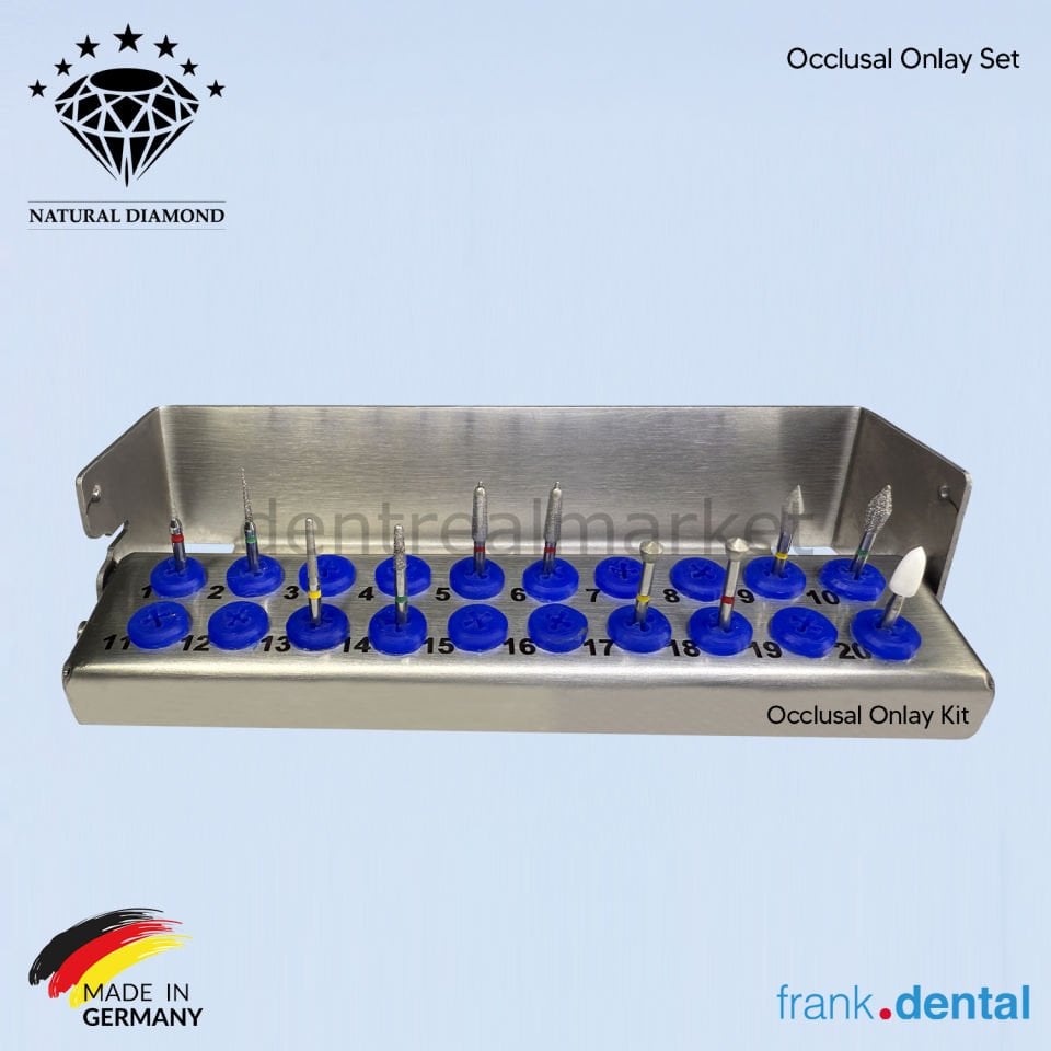 Occlusal Onlay Set - Elmas Frez