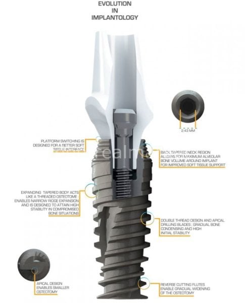 Titanyum İmplant ve Üst Yapı Dahil Çap:5 mm