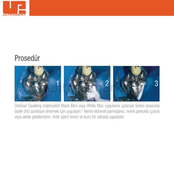 Oraseal Caulking Refil
