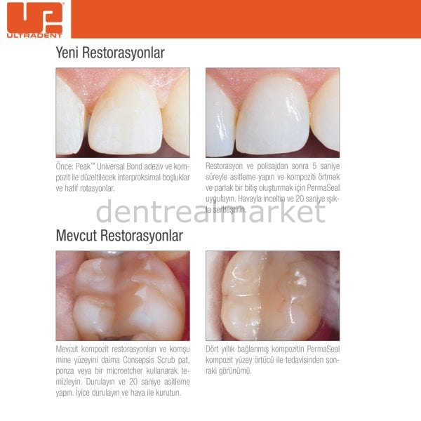 PermaSeal Rezin Esaslı Yüzey Örtücü Kit