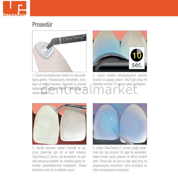 Cleartemp LC Geçici Veener Siman Kit