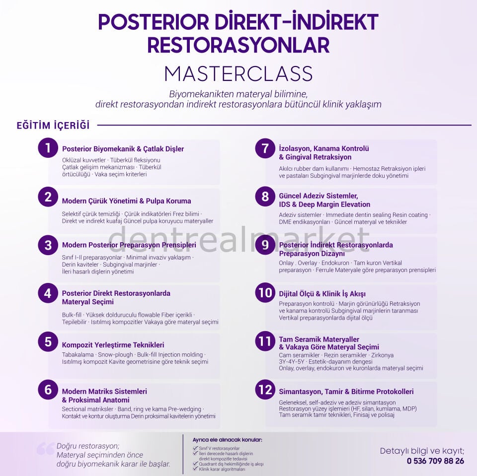Posterior Direkt -  İndirekt Restorasyonlar Masterclass - Dr. Hakan Çolak