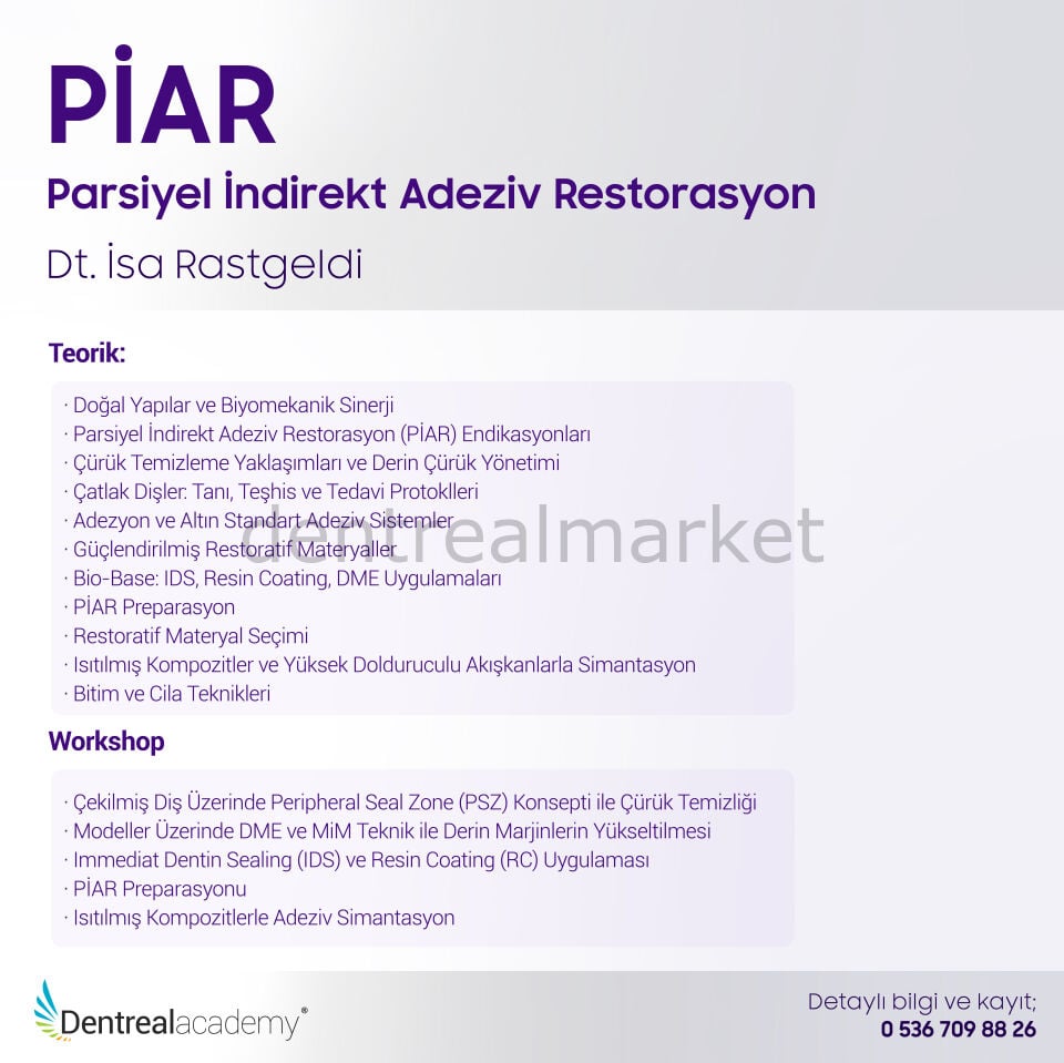 PİAR - Parsiyel İndirekt Adeziv Restorasyon - Dt. İsa Rastgeldi