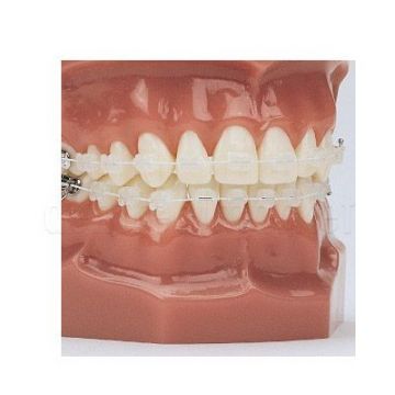 EverWhite Niti Cosmetic Orthodontik Wire Köşeli