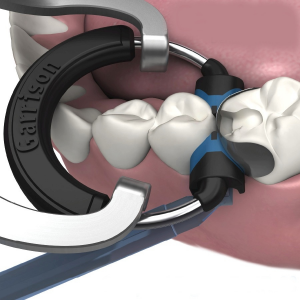Bicuspid Matris Bandı Refil