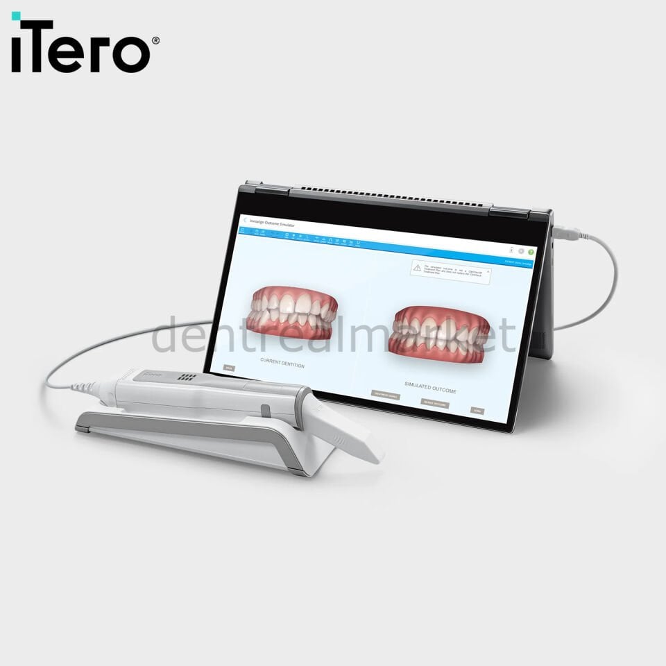 Element 5D Laptop İntraoral Scanner - iTero Ağız İçi Tarayıcı