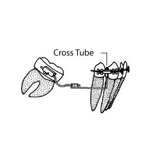 Cross Tubes Tüp - 10 Adet