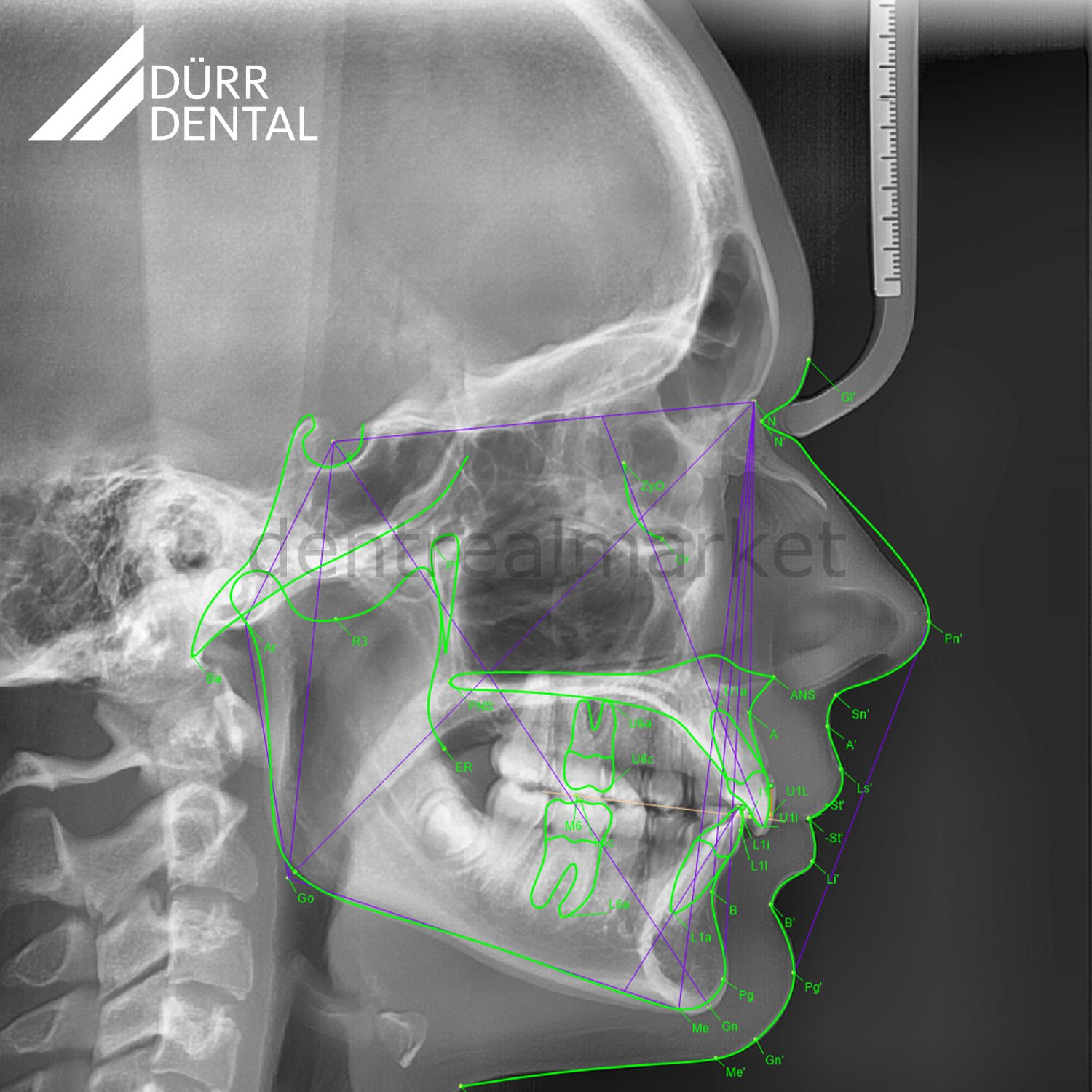 Pan Röntgen VistaVox S Ceph 3D Volumetrik Tomografi & Pan & Sef Röntgen | Dürr Dental