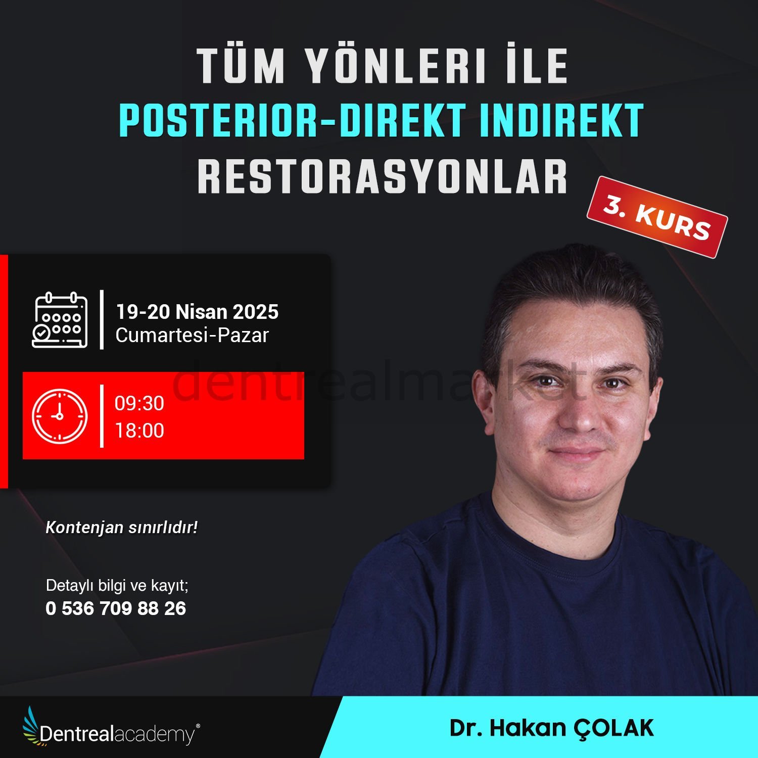 Tüm Yönleriyle Posterior-Direkt İndirekt Restorasyonlar - Dr. Hakan Çolak
