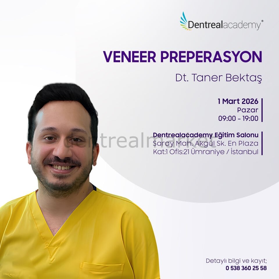 Veneer Preperasyon - Hands-On - Dt. Taner Bektaş