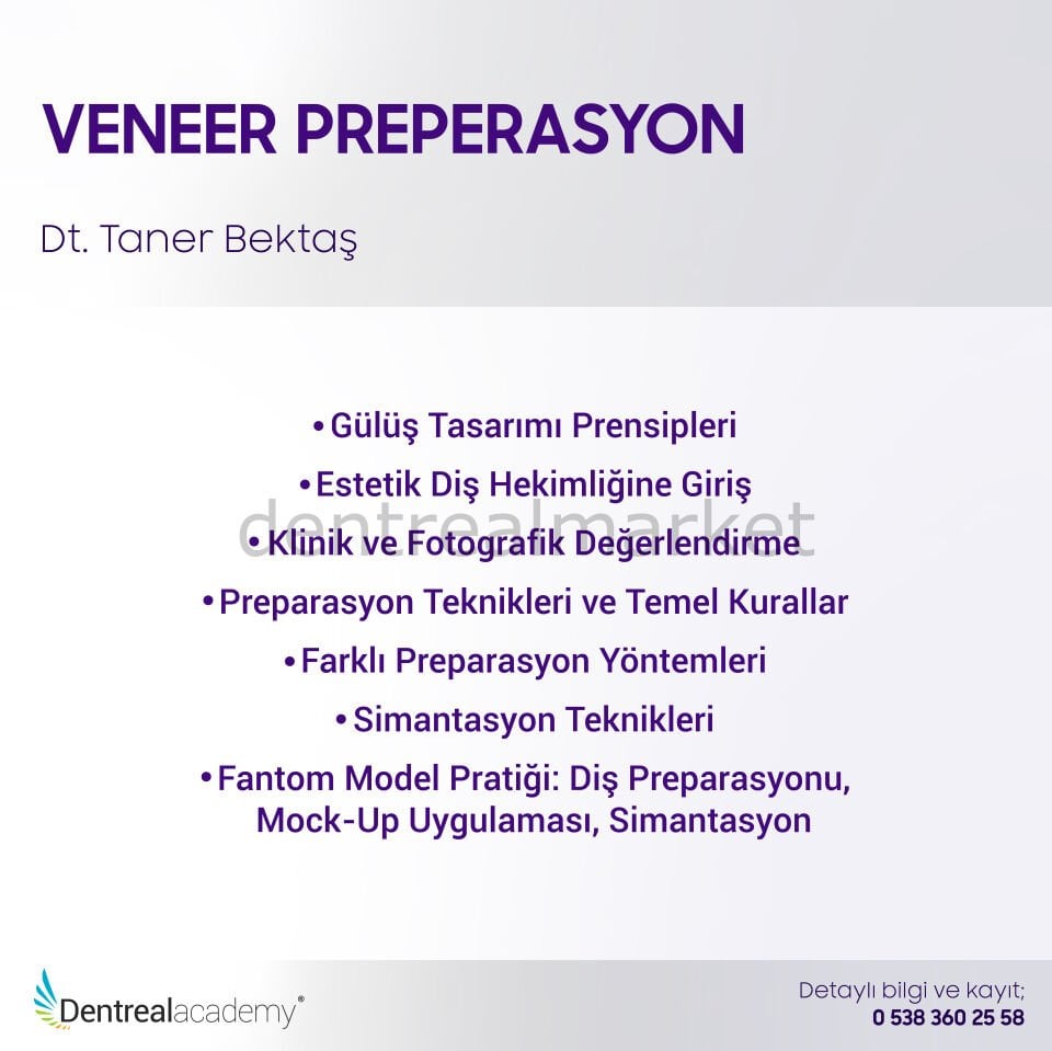 Veneer Preperasyon - Hands-On - Dt. Taner Bektaş