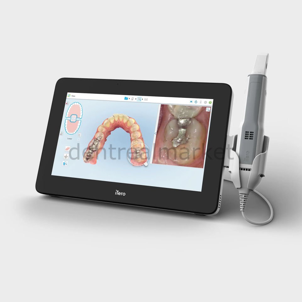 Element 5D Plus Mobil İntraoral Scanner - iTero Ağız İçi Tarayıcı