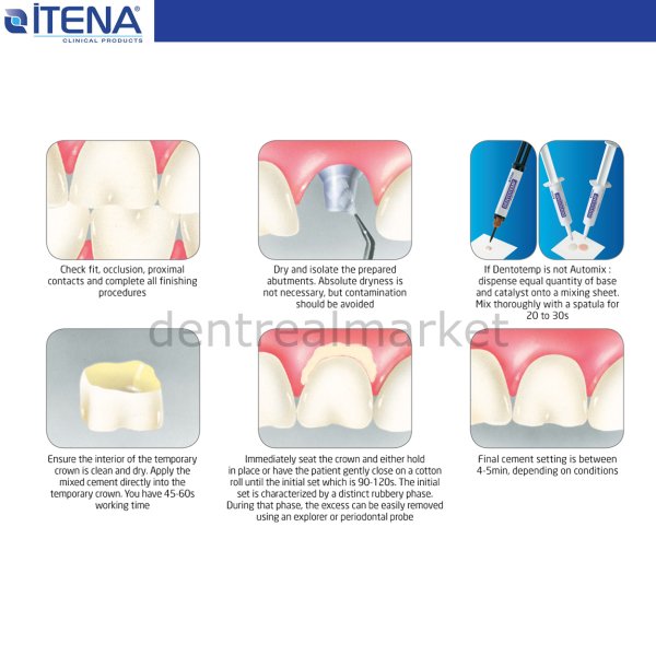 Dentotemp Automix İmplant Simanı 2x6 gr