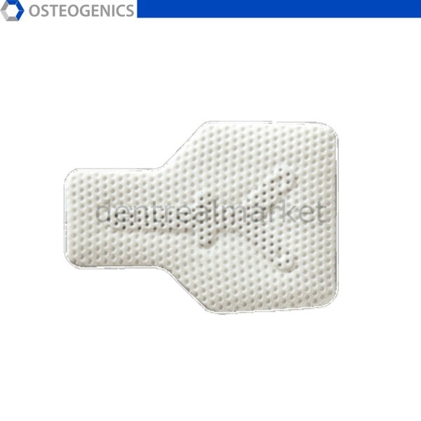 Cytoplast Titanyum Destekli Membran - 17x25 mm - Buccal
