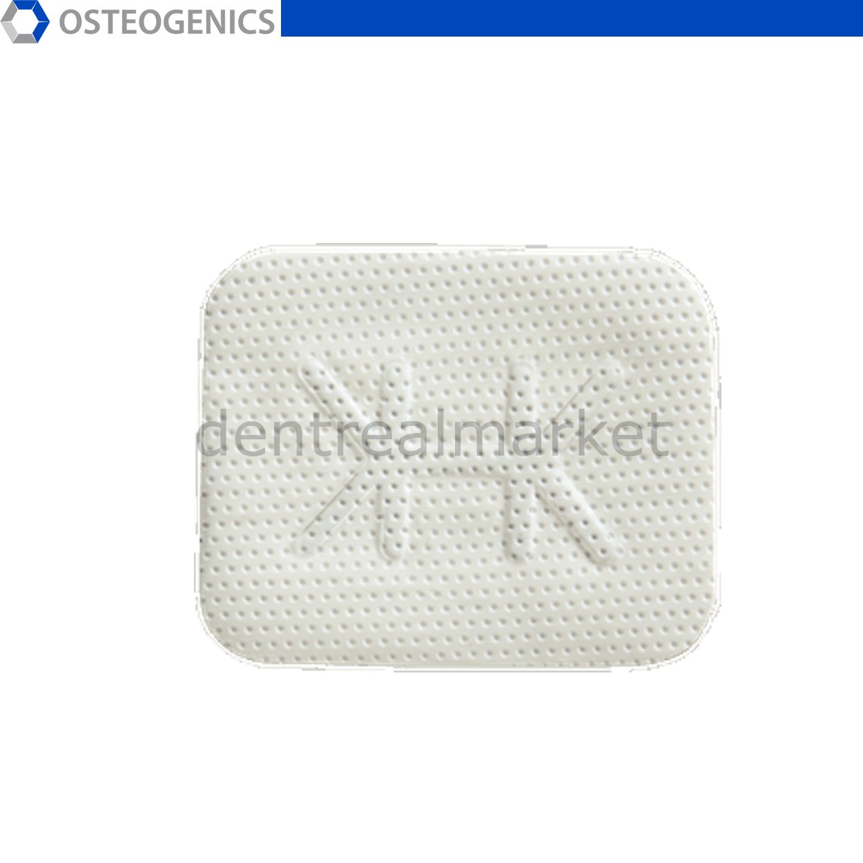 Cytoplast Titanyum Destekli Membran - 20x25 mm - Posterior