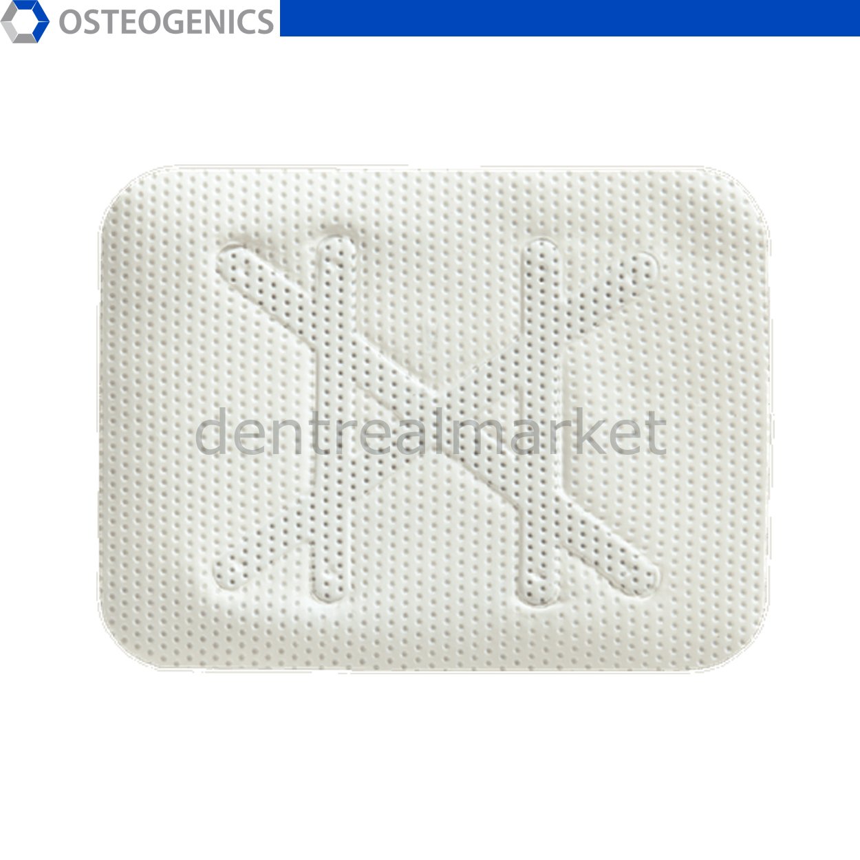 Cytoplast Titanyum Destekli Membran XL - 30x40 mm