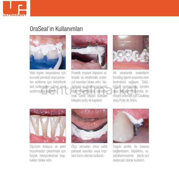 Oraseal Caulking ve Putty Kit