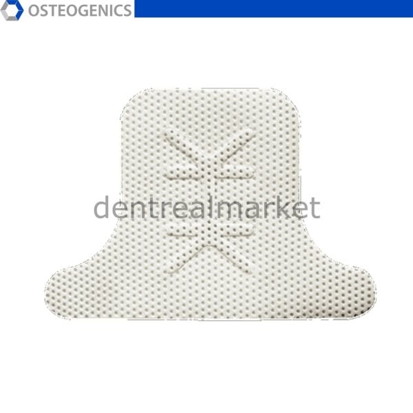 Cytoplast Titanyum Destekli Membran - 30x41 mm - Posterior LargeT2