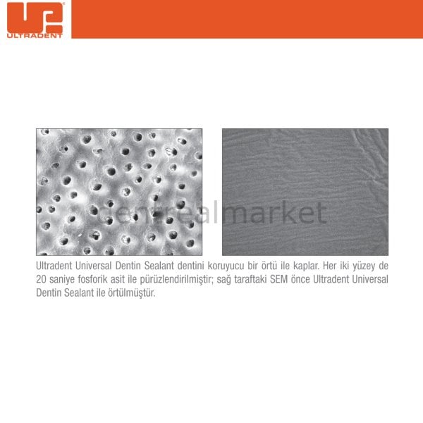Universal Dentin Sealant Kit