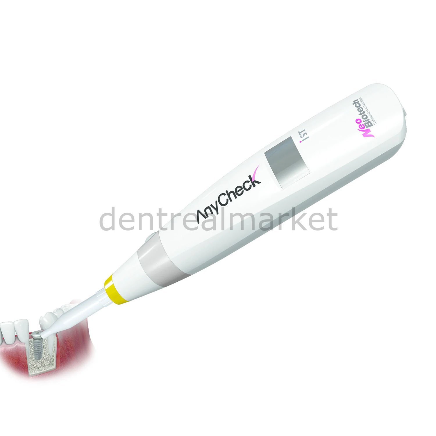 Anycheck İmplant Stabilite Ölçüm Cihazı