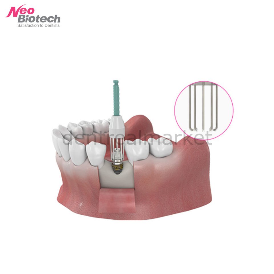 R-Brush Peri-İmplantitis Fırçası