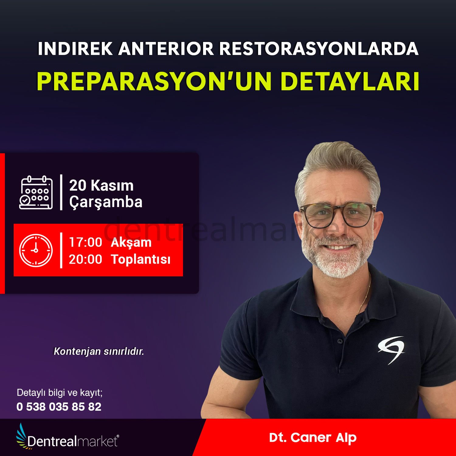 Indirek Anterior Restorasyonlarda Preparasyon'un Detayları - Dt. Caner Alp
