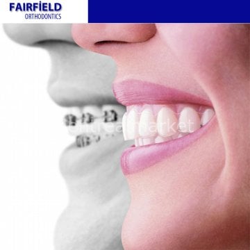 Orthodonti Profesyonel İntro Set