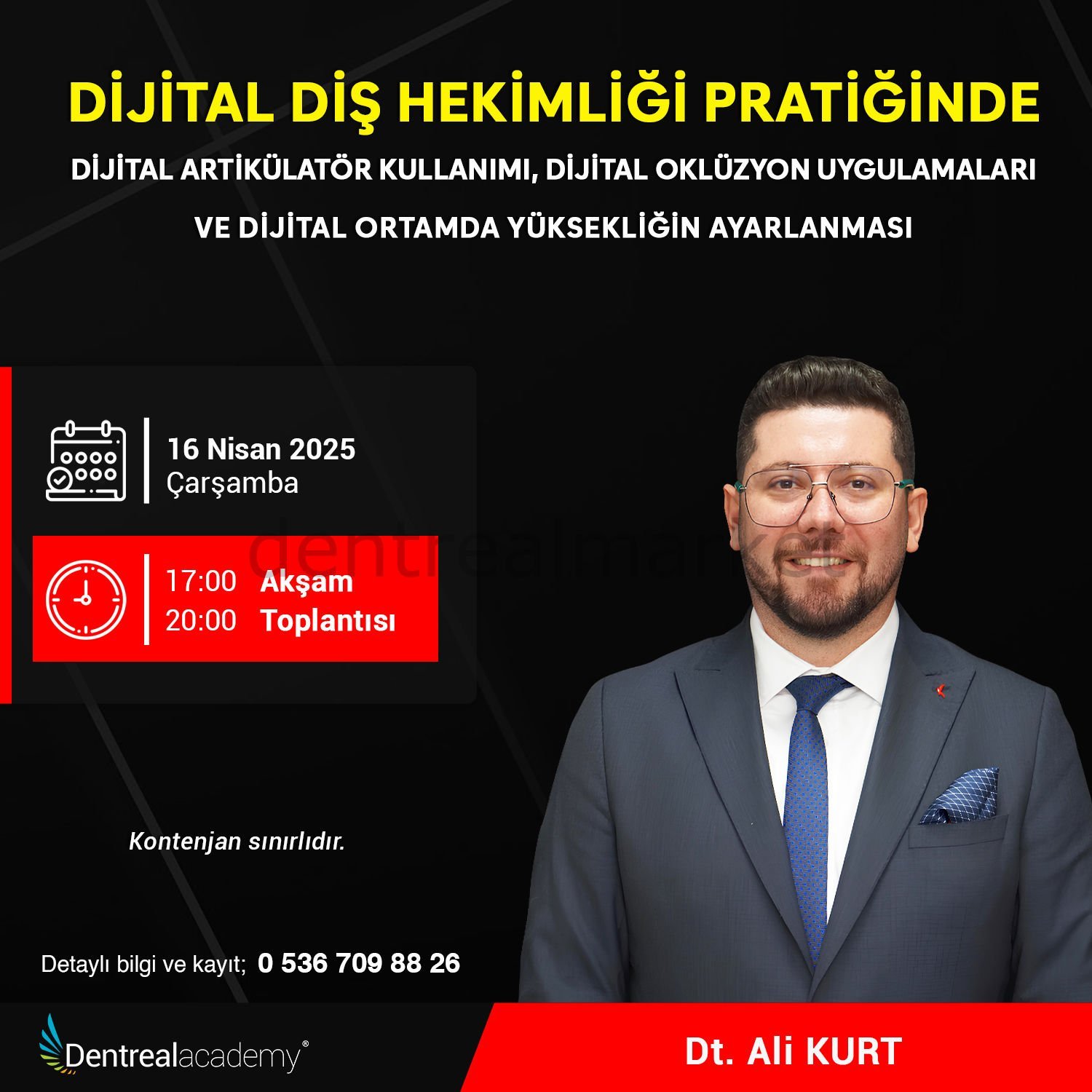 Dijital Diş Hekimliği Pratiğinde Dijital Artikülatör Kullanımı ve Oklüzyon Uygulamaları - Dt. Ali Kurt