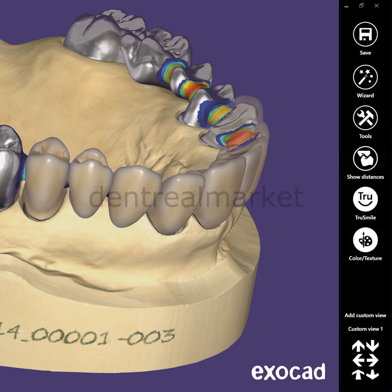 EXOCAD Dental Tarayıcı Yazılımı Temel Dongle (Kron ve Köprü)