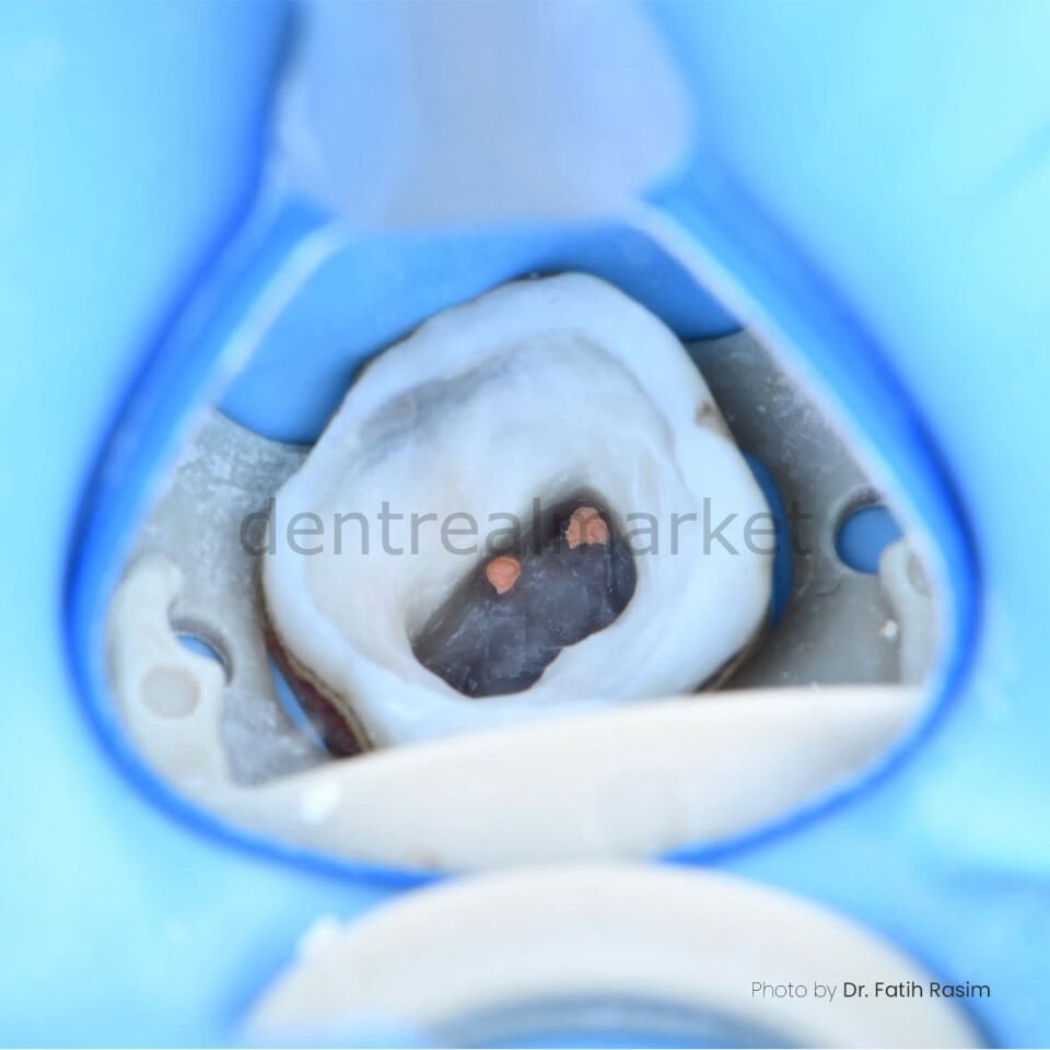 Yirro Mirror No.0 Ayna Başlığı 6 Adet