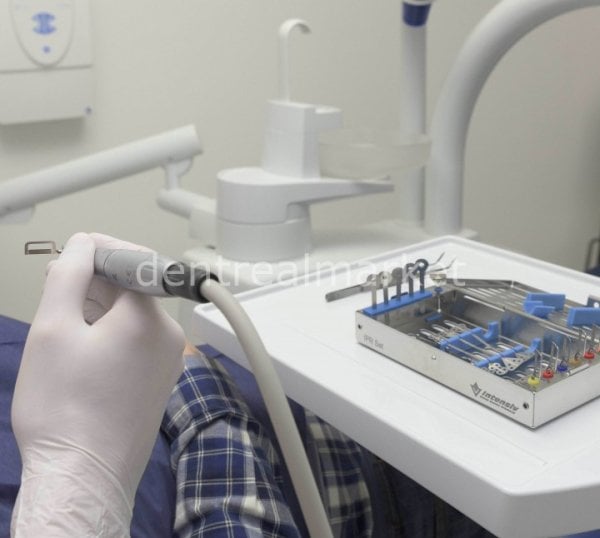 IPR InterProximal Reduction - Set