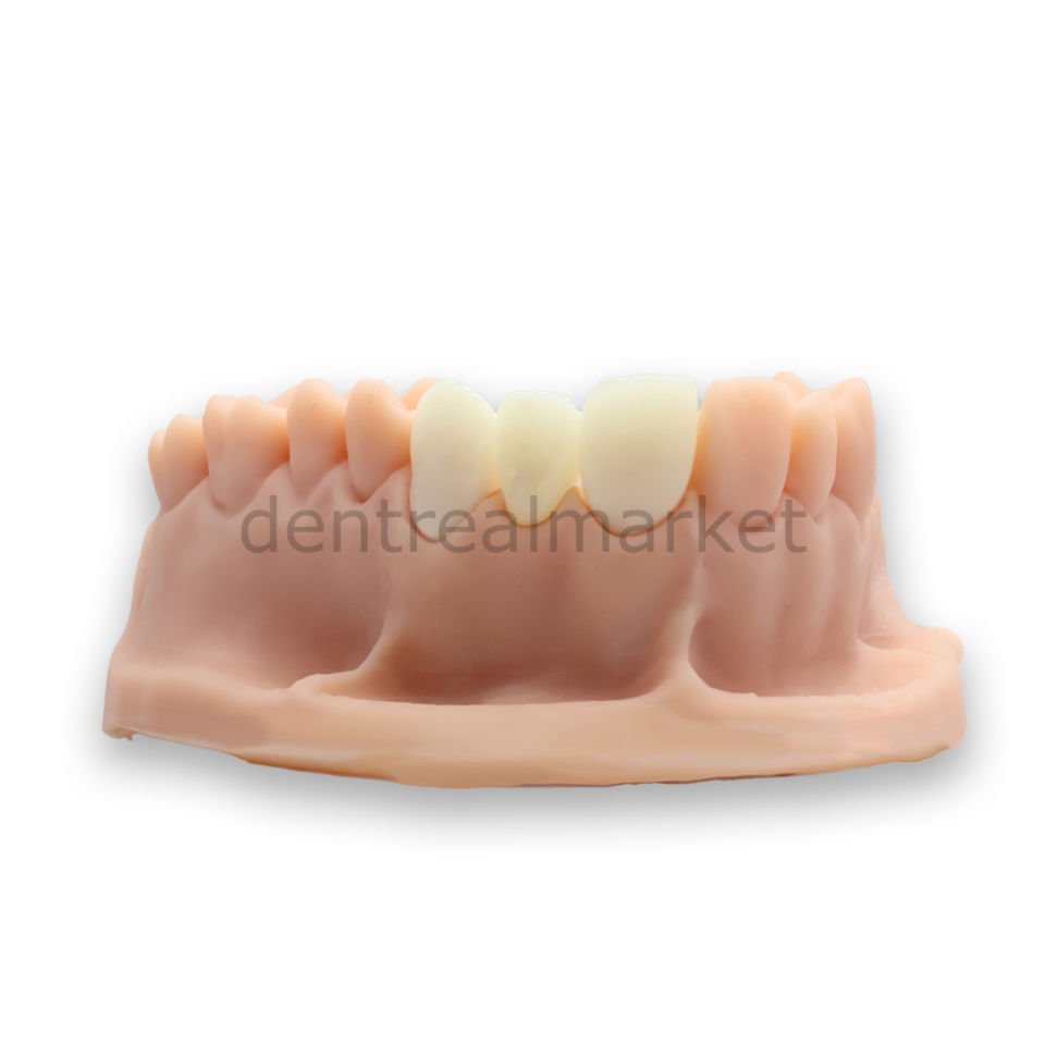 3D Yazıcı Reçine - C&B Temp - Geçici Kron Köprü Reçinesi - 1000 gr
