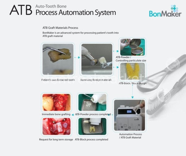 BonMaker ATB Greft Sistem - Diş Öğütücü