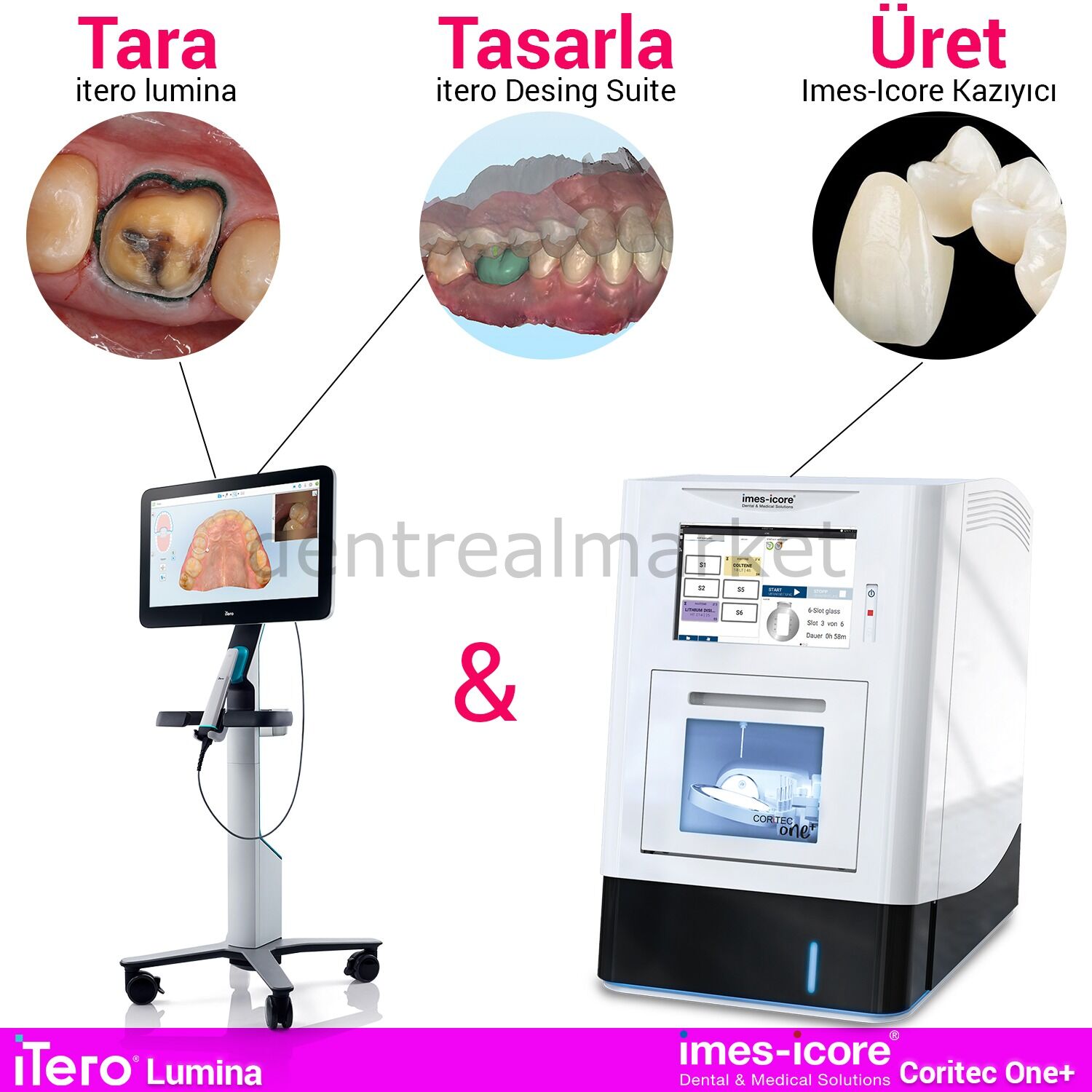 CORiTEC one+ Chairside Kazıyıcı & İtero Lumina Tarayıcı