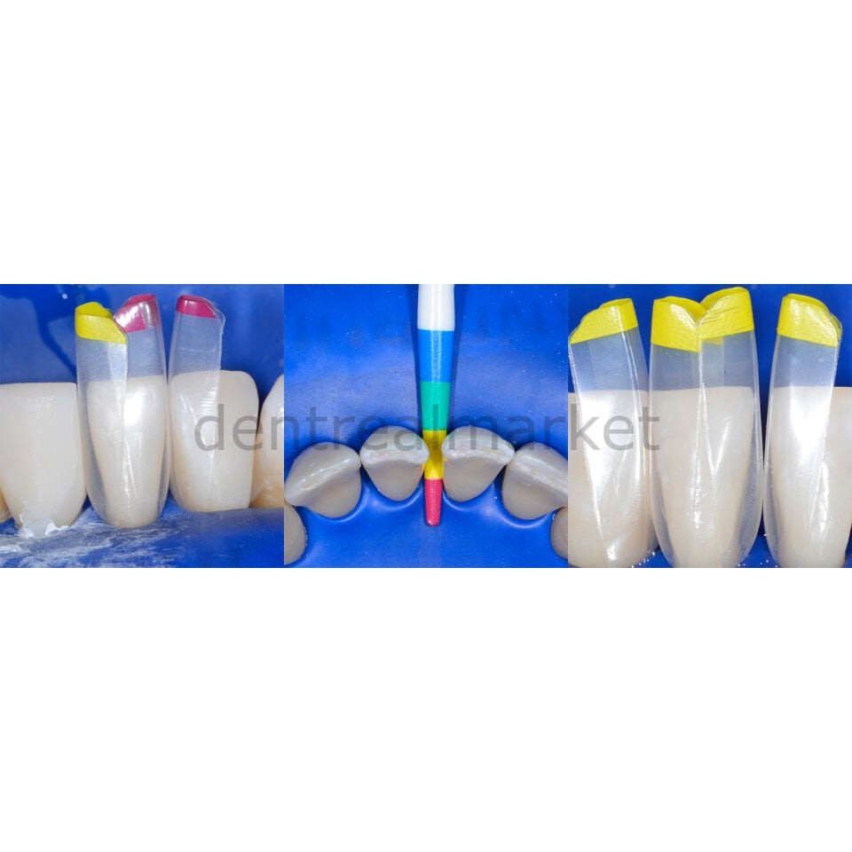 Intro Black Triangle (BT) Matrix Seti