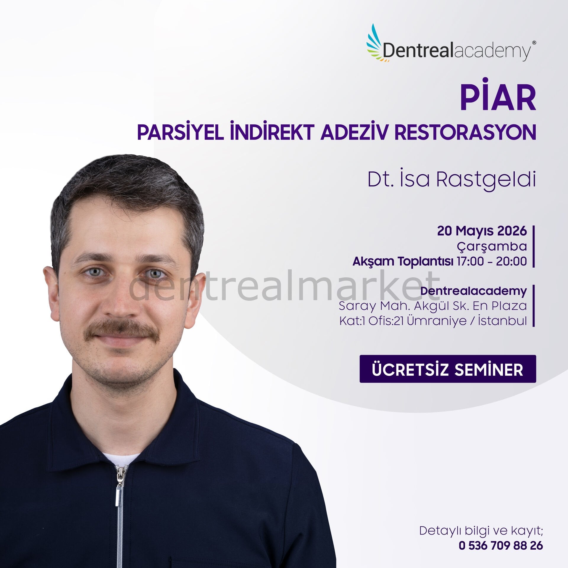 PİAR - Parsiyel İndirekt Adeziv Restorasyon - Dt. İsa Rastgeldi