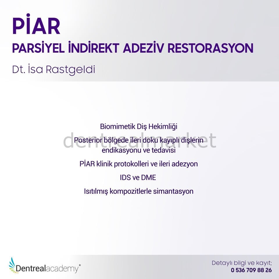 PİAR - Parsiyel İndirekt Adeziv Restorasyon - Dt. İsa Rastgeldi