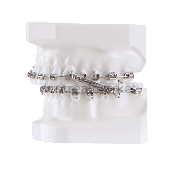 CS5 Class II & Class III Corrector with Traditional Pivot - 5 Patient Kit