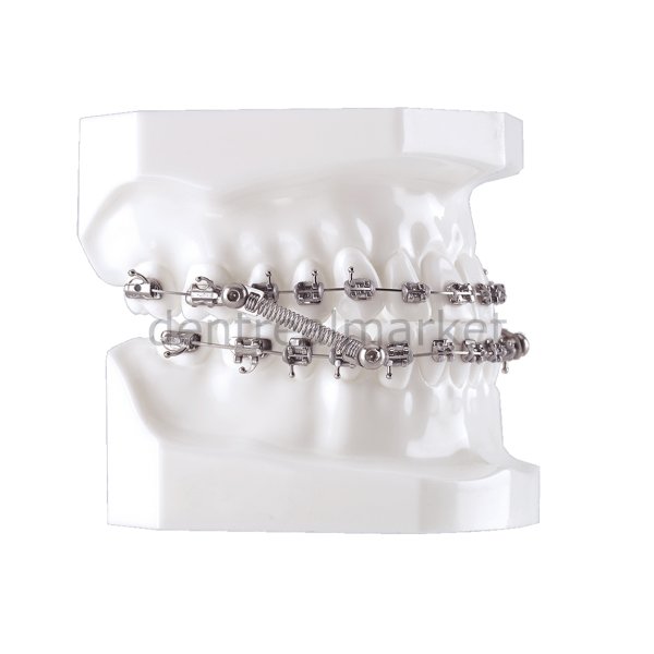 CS5 Class II & Class III Corrector with Traditional Pivot - 5 Patient Kit