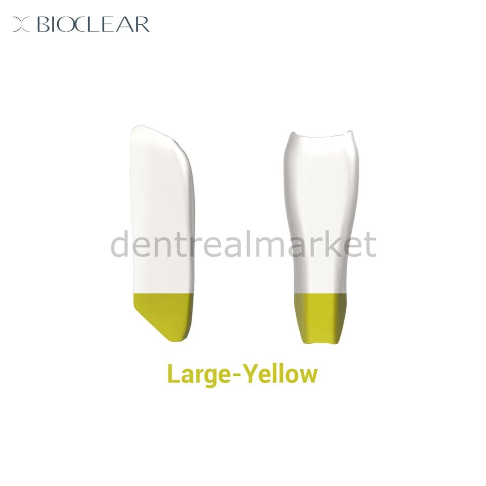 Black Triangle Individual Matrix - Large/Yellow - 10 Adet