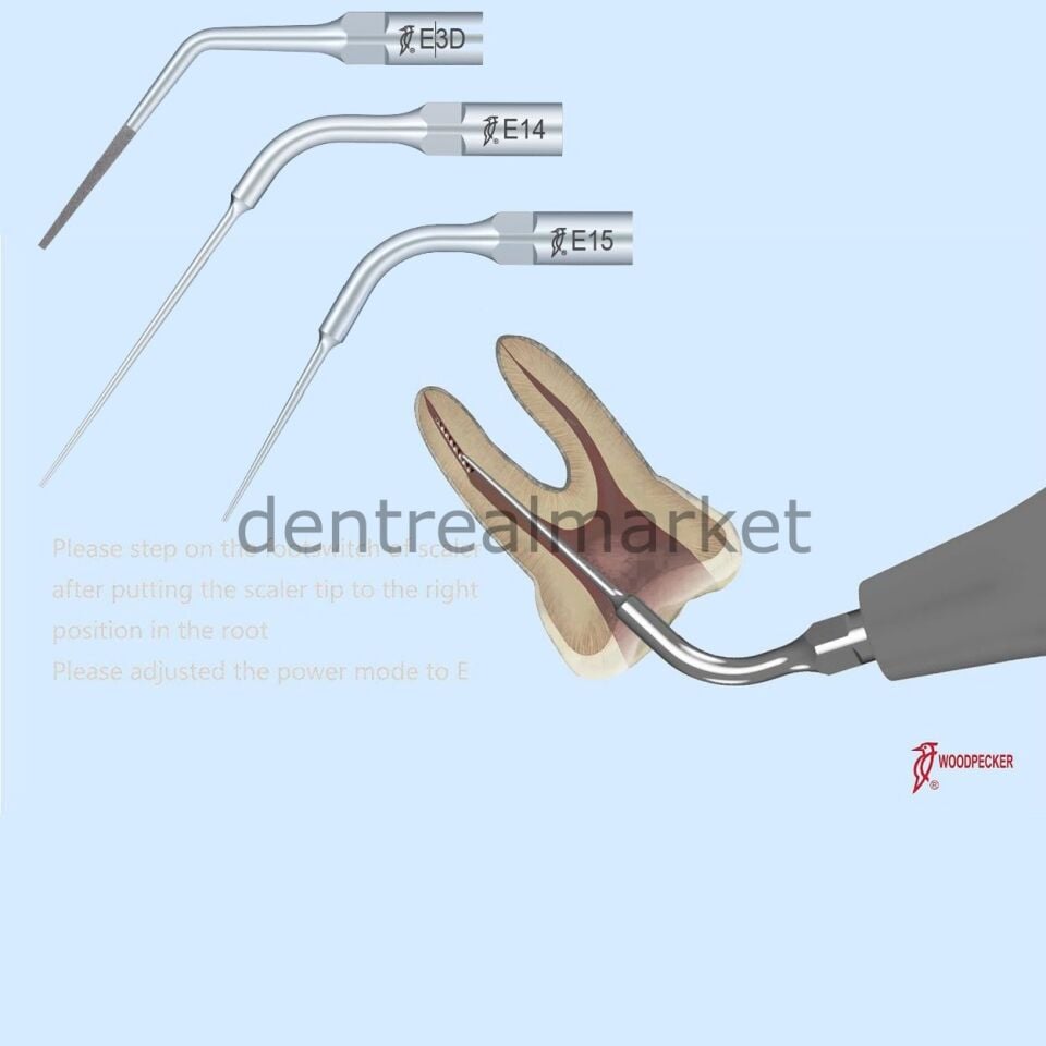 Kırık Kanal Eğesi Çıkarma Uçları Refil E15