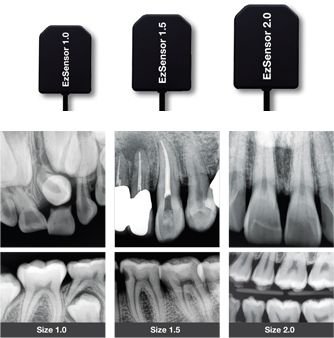 X-Visus Size 1 - İntraoral X-Ray Sensörü RVG