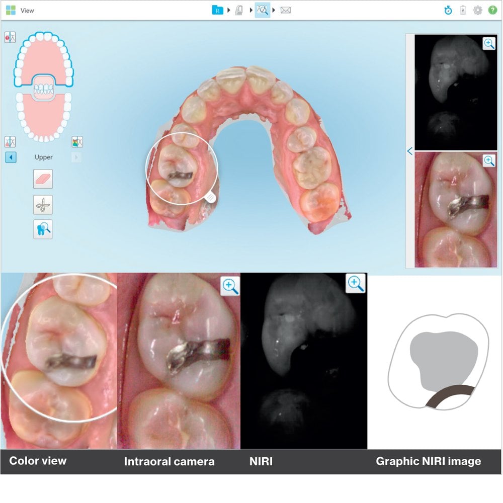 iTero Element 5D Ağız içi Tarayıcı Scanner