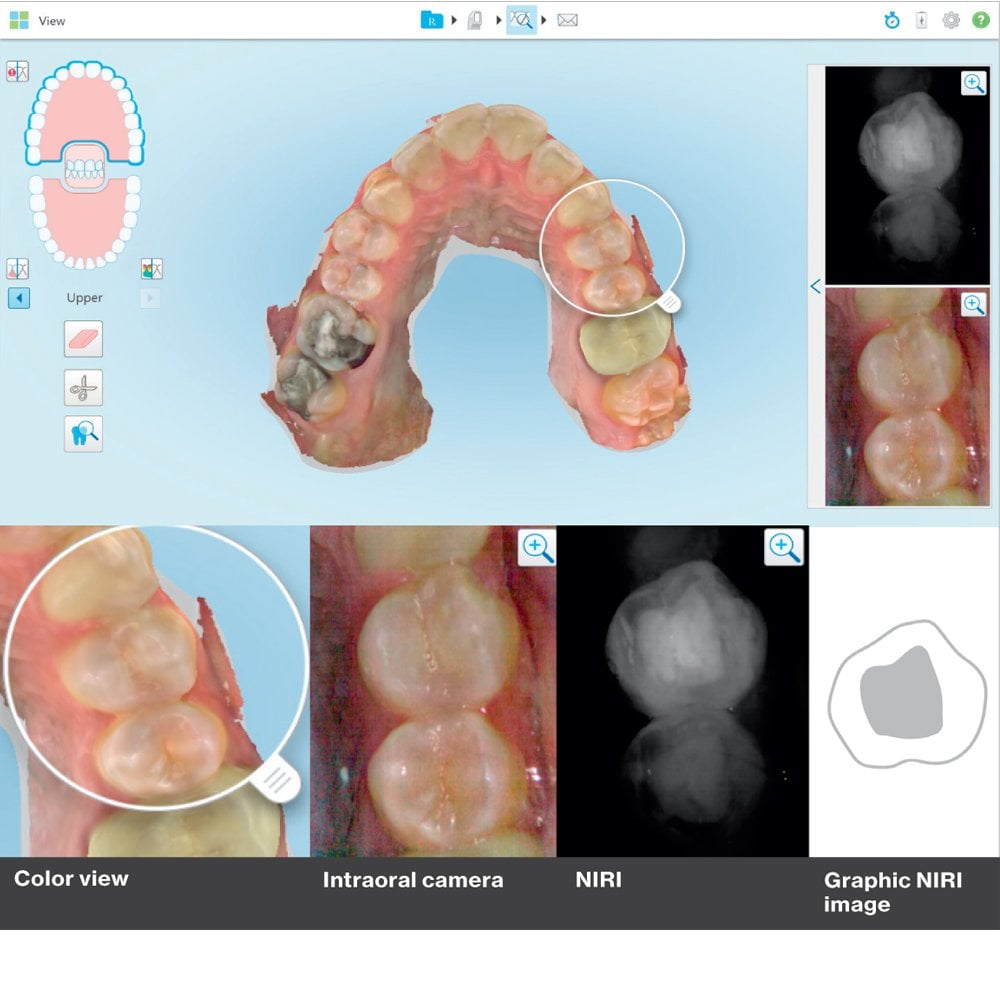 iTero Element 5D Ağız içi Tarayıcı Scanner